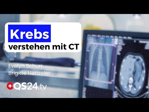 Wie ein Hirn-CT die wahre Ursache einer Krebserkrankung sichtbar machte | Erfahrungsmedizin | QS24