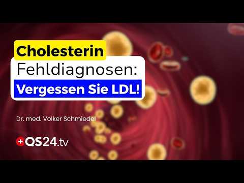 Cholesterin-Fehldiagnosen: 90 % nehmen Statine, die sie gar nicht brauchen! | QS24