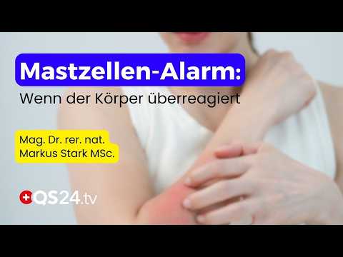 Histaminfalle: Warum dein Körper ständig auf Alarm schaltet | Naturmedizin | QS24 Histaminfalle: Warum dein Körper ständig auf Alarm schaltet | Naturmedizin | QS24