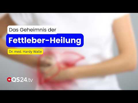 S3-Leitlinie: So schaffte es ein Ernährungsprogramm in die Spitzenmedizin! | QS24 Gremium S3-Leitlinie: So schaffte es ein Ernährungsprogramm in die Spitzenmedizin! | QS24 Gremium